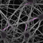 Hippocampal neurons labeled for neurofascin (magenta) and microtubules (grey)