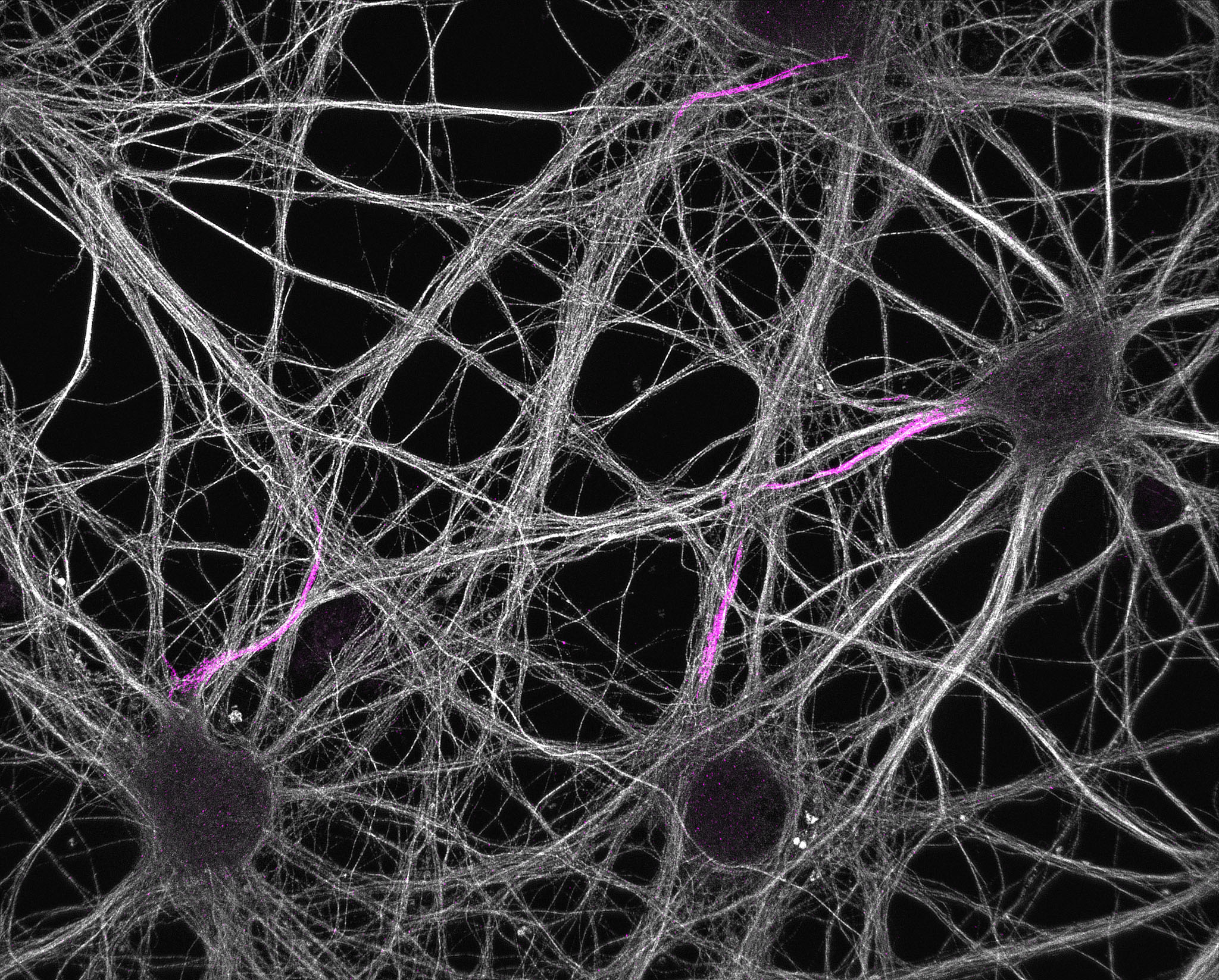 Hippocampal neurons labeled for neurofascin (magenta) and microtubules (grey)