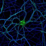 Hippocampal neuron labeled for actin (green), microtubules (blue) and neurofascin (red)