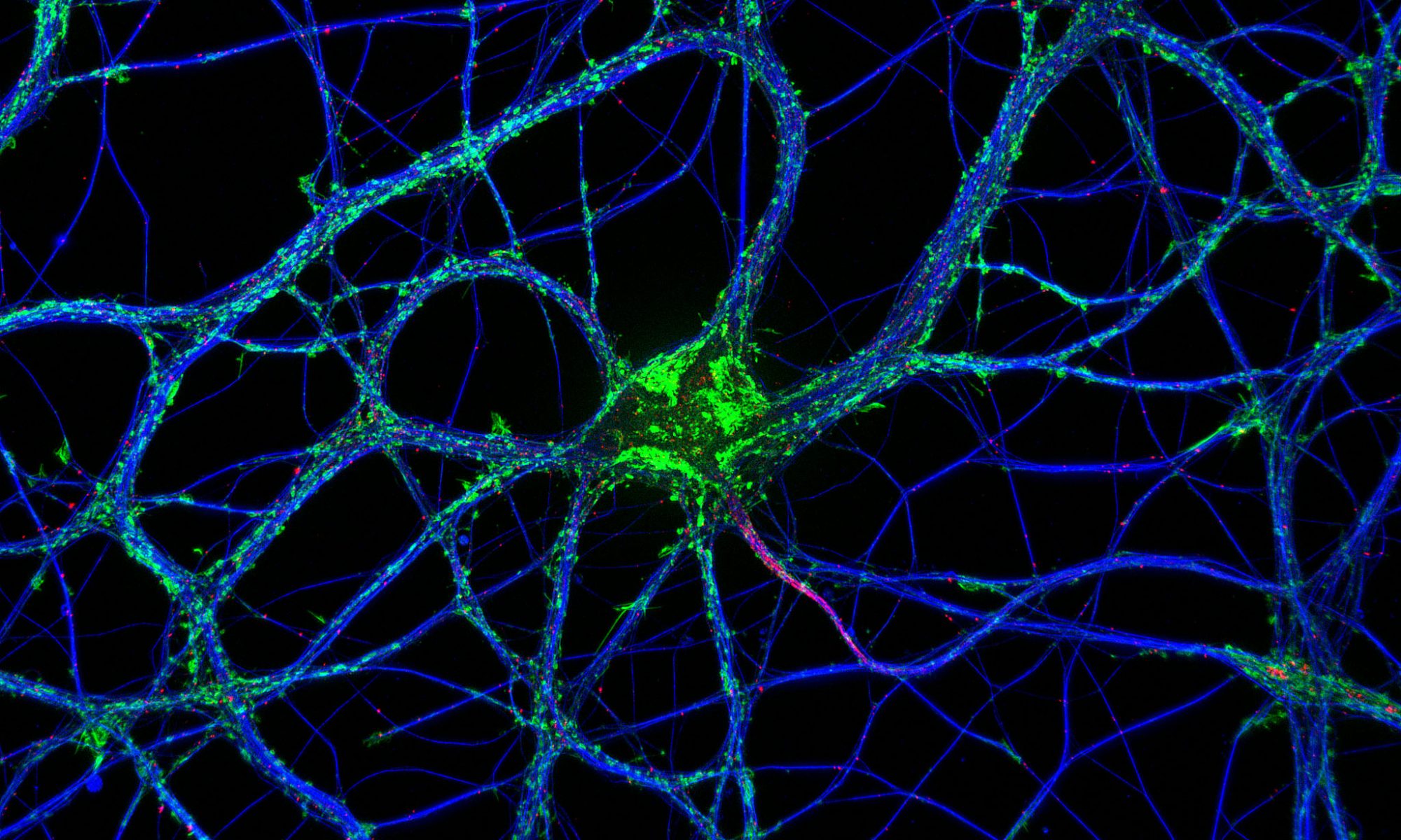 Hippocampal neuron labeled for actin (green), microtubules (blue) and neurofascin (red)