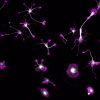 Young hippocampal neurons labeled for microtubules (grey) and actin (magenta)