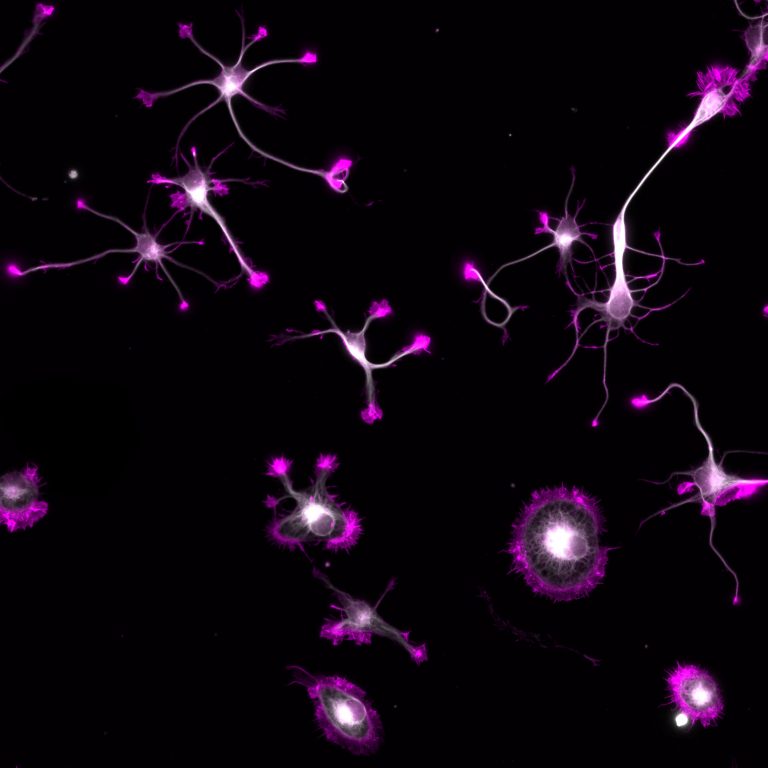 Young hippocampal neurons labeled for microtubules (grey) and actin (magenta)