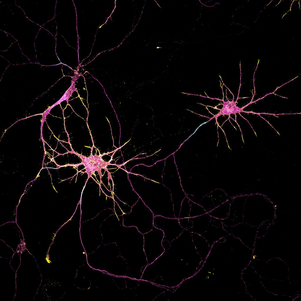 Hippocampal neurons labeled for beta4-spectrin (cyan), beta2-spectrin (magenta), and actin (yellow)
