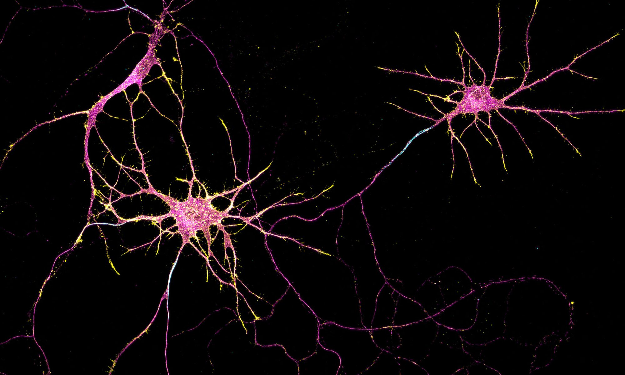 Hippocampal neurons labeled for beta4-spectrin (cyan), beta2-spectrin (magenta), and actin (yellow)