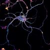 Hippocampal neuron labeled for beta2-spectrin (cyan) and actin (yellow)