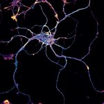Hippocampal neuron labeled for beta2-spectrin (cyan) and actin (yellow)