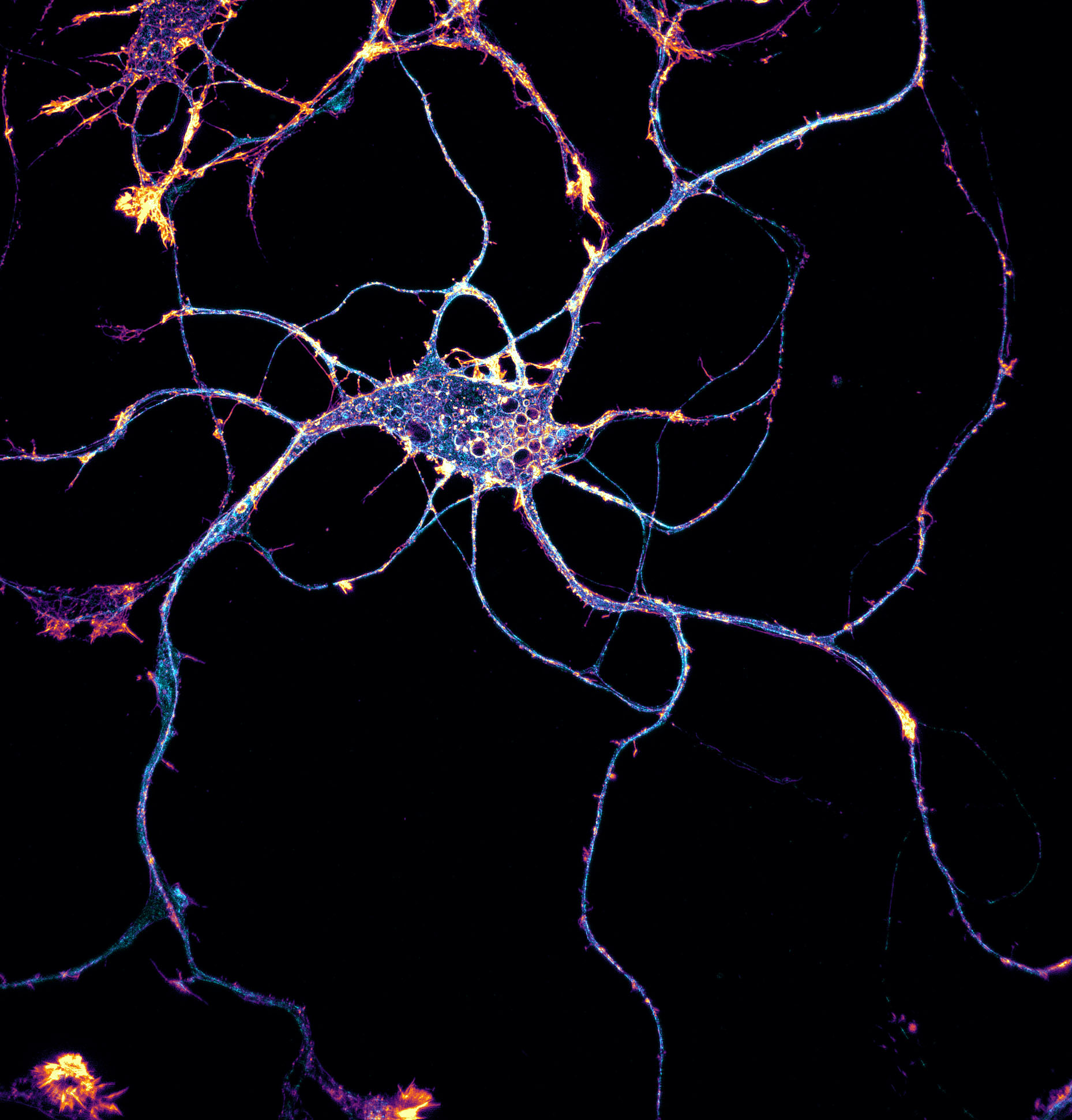 Hippocampal neuron labeled for beta2-spectrin (cyan) and actin (yellow)
