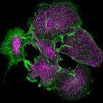 COS cells labeled for actin (green) and microtubules (magenta)