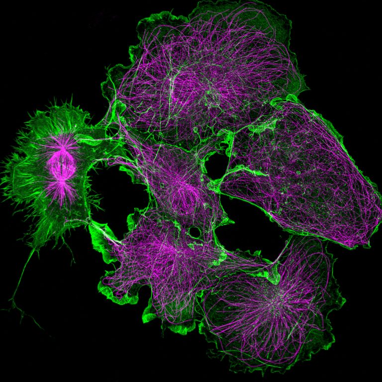 COS cells labeled for actin (green) and microtubules (magenta)