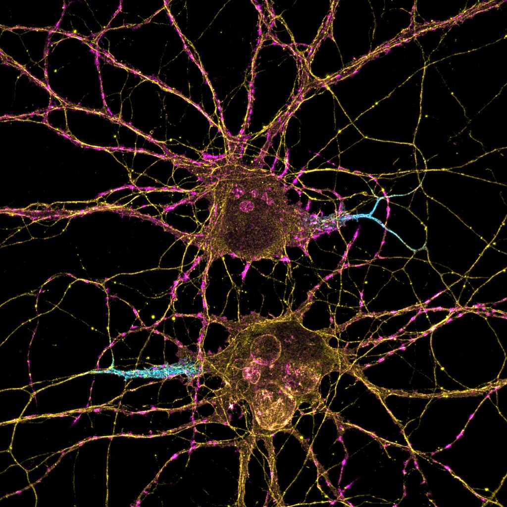 Mature hippocampal neurons labeled for beta4-spectrin (cyan), beta2-spectrin (yellow) and actin (magenta)