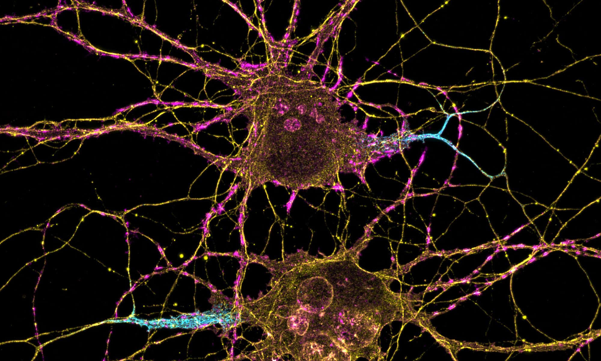 Mature hippocampal neurons labeled for beta4-spectrin (cyan), beta2-spectrin (yellow) and actin (magenta)