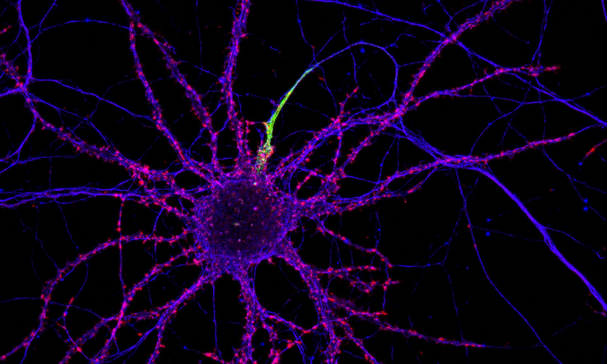 Mature hippocampal neurons labeled for beta4-spectrin (cyan), beta2-spectrin (yellow) and actin (magenta)