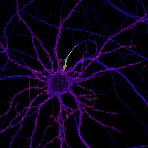 Mature hippocampal neurons labeled for beta4-spectrin (cyan), beta2-spectrin (yellow) and actin (magenta)