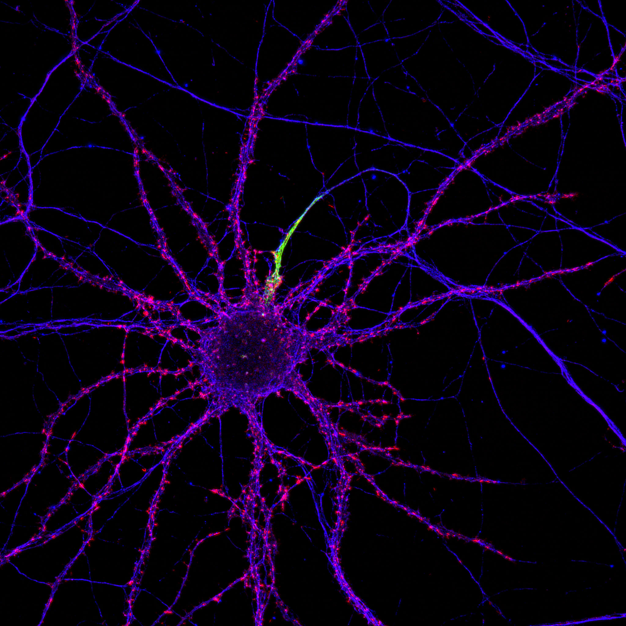 Mature hippocampal neurons labeled for beta4-spectrin (cyan), beta2-spectrin (yellow) and actin (magenta)