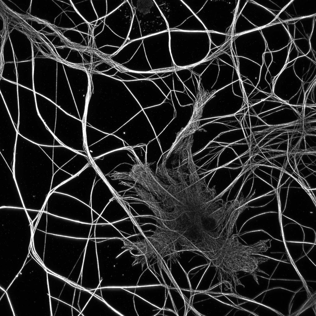 Glial cell surrounded by axons (microtubules labelling)