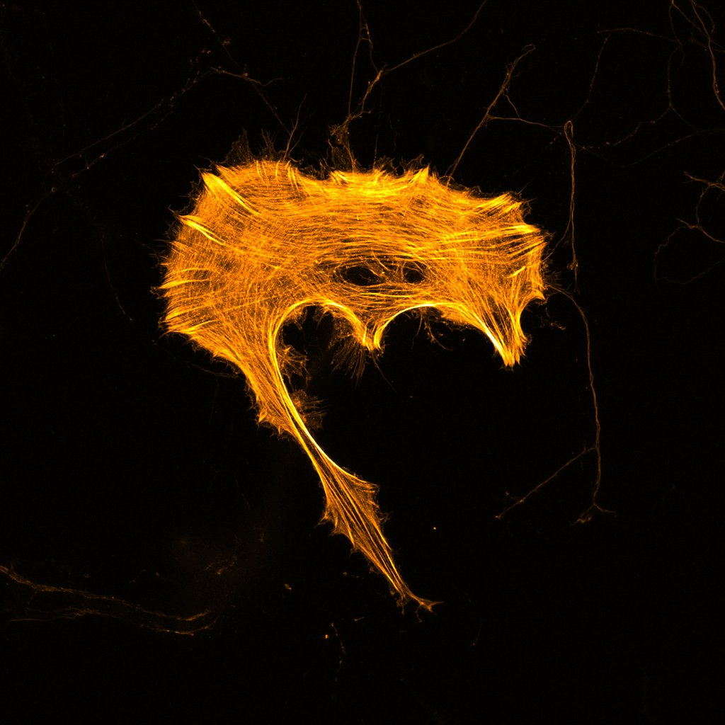 Glia labeled for actin