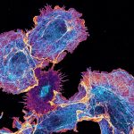 COS cells labeled for actin (orange) and microtubules (cyan) COS cells labeled for actin (orange) and microtubules (cyan)