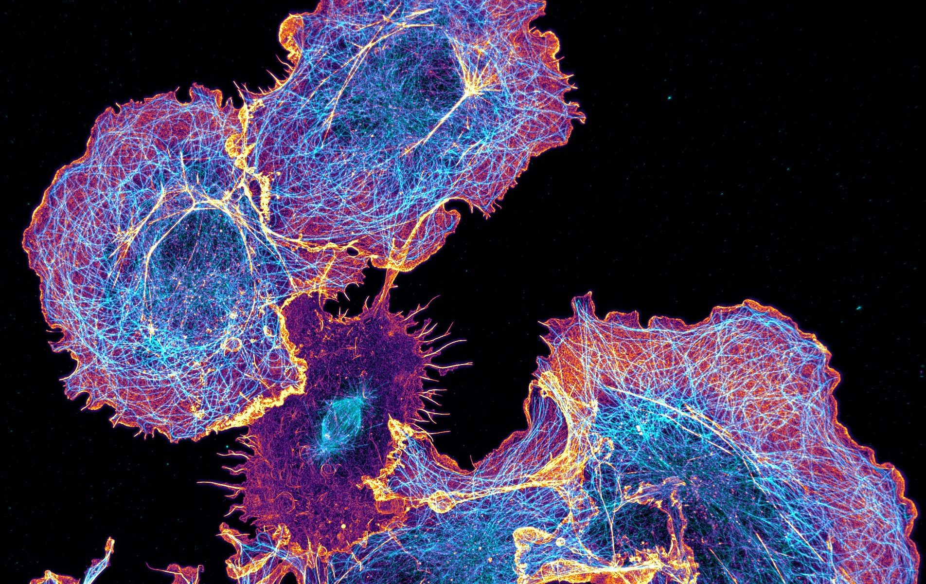 COS cells labeled for actin (orange) and microtubules (cyan) COS cells labeled for actin (orange) and microtubules (cyan)