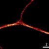 STED images of axons labeled for ß2-spectrin (orange), and ß2-spectrin and adducin (green and red) STED images of axons labeled for ß2-spectrin (orange), and ß2-spectrin and adducin (green and red)