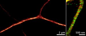 STED images of axons labeled for ß2-spectrin (orange), and ß2-spectrin and adducin (green and red) STED images of axons labeled for ß2-spectrin (orange), and ß2-spectrin and adducin (green and red)