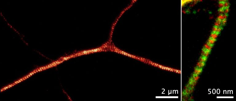STED images of axons labeled for ß2-spectrin (orange), and ß2-spectrin and adducin (green and red) STED images of axons labeled for ß2-spectrin (orange), and ß2-spectrin and adducin (green and red)