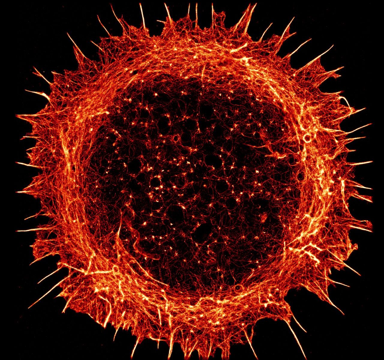 STORM image of a young hippocampal neuron stained for actin STORM image of a young hippocampal neuron stained for actin