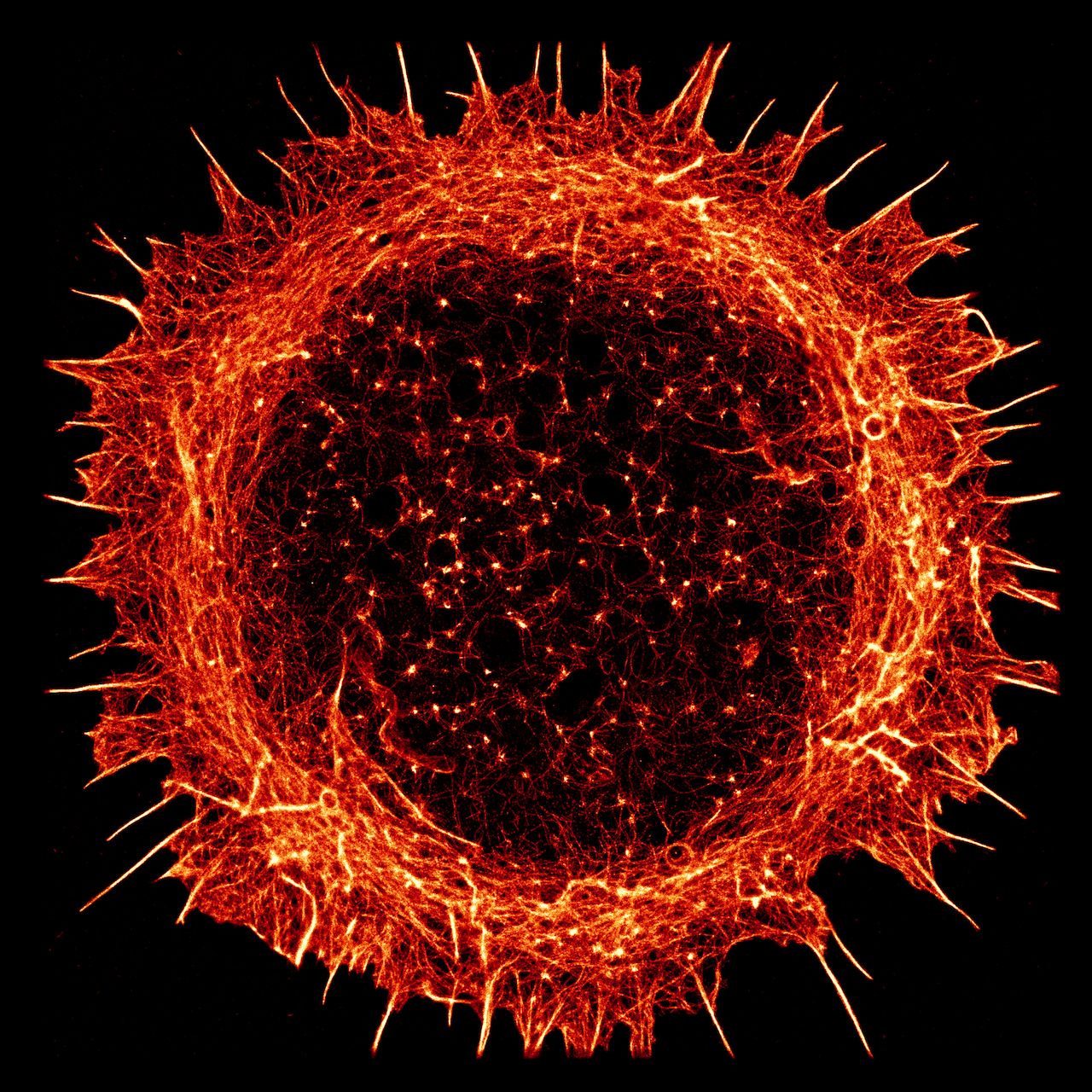 STORM image of a young hippocampal neuron stained for actin STORM image of a young hippocampal neuron stained for actin