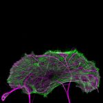 A neuron on top of a glia labeled for actin (green) and microtubules (magenta)
