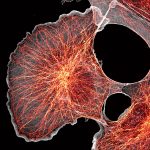 Super-resolution spinning disk image of COS cells labeled for actin (grey) and microtubules (orange) Super-resolution spinning disk image of COS cells labeled for actin (grey) and microtubules (orange)