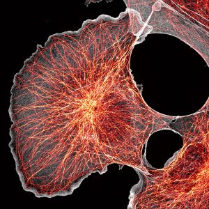 Super-resolution spinning disk image of COS cells labeled for actin (grey) and microtubules (orange) Super-resolution spinning disk image of COS cells labeled for actin (grey) and microtubules (orange)