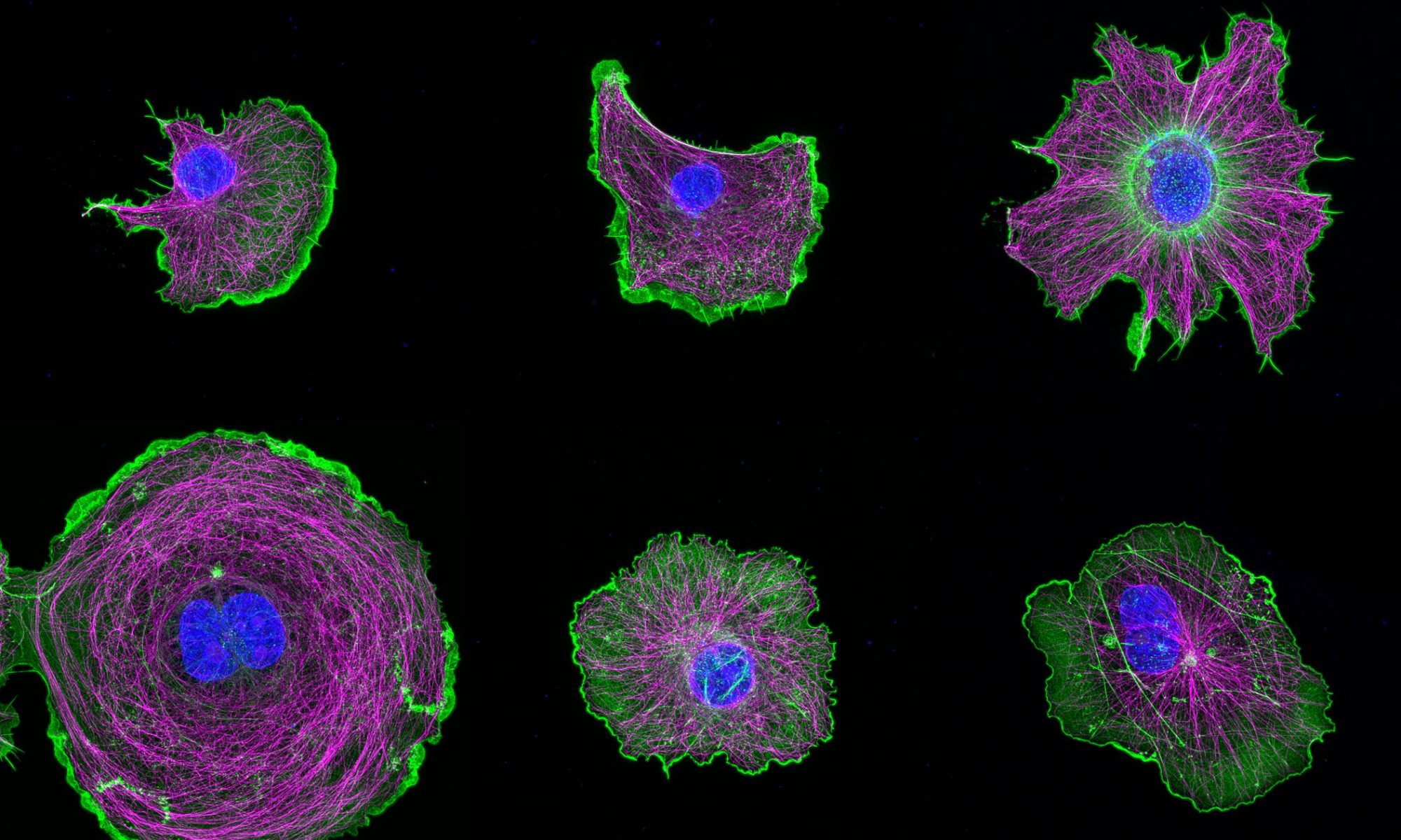 Gallery of COS cells labeled for actin (green), microtubules (magenta) and nucleus (blue) Gallery of COS cells labeled for actin (green), microtubules (magenta) and nucleus (blue)