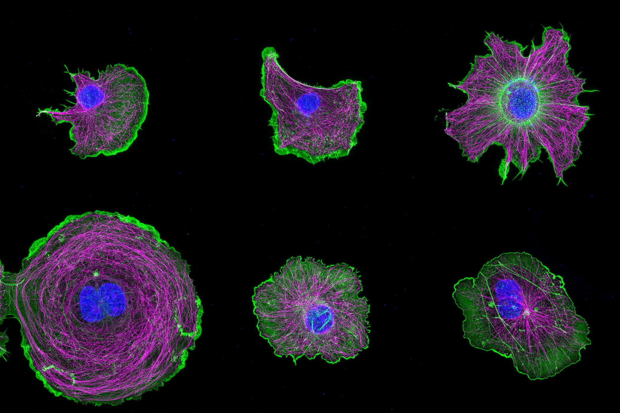 Gallery of COS cells labeled for actin (green), microtubules (magenta) and nucleus (blue) Gallery of COS cells labeled for actin (green), microtubules (magenta) and nucleus (blue)