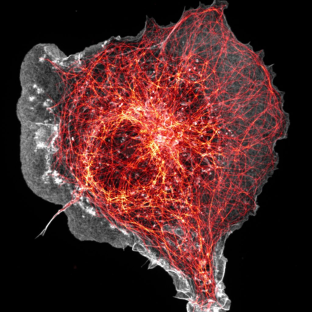 COS cell labeled for microtubules (orange) and actin (grey) COS cell labeled for microtubules (orange) and actin (grey)