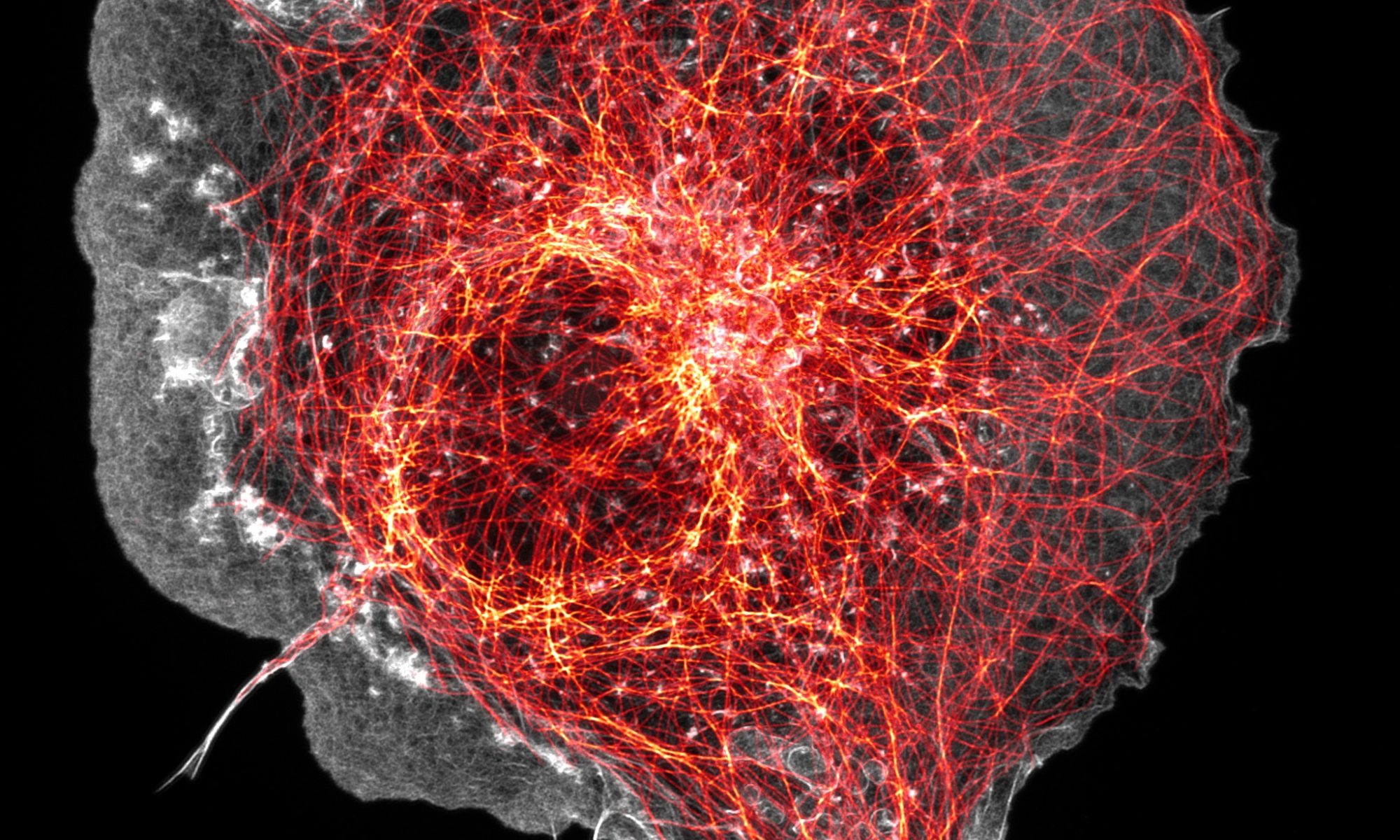 COS cell labeled for microtubules (orange) and actin (grey)