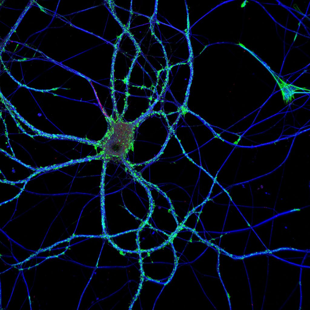 Hippocampal neuron labeled for actin (green), microtubules (blue) and neurofascin (red)