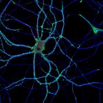 Hippocampal neuron labeled for actin (green), microtubules (blue) and neurofascin (red)