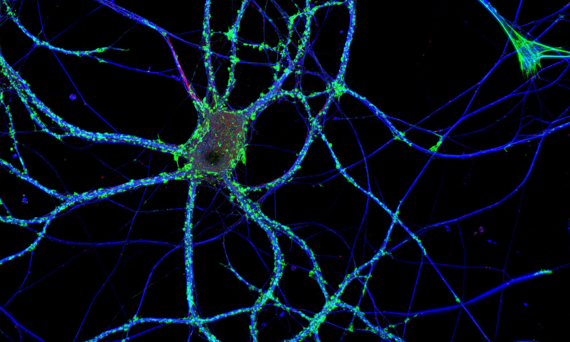 Hippocampal neuron labeled for actin (green), microtubules (blue) and neurofascin (red)