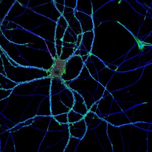Hippocampal neuron labeled for actin (green), microtubules (blue) and neurofascin (red)