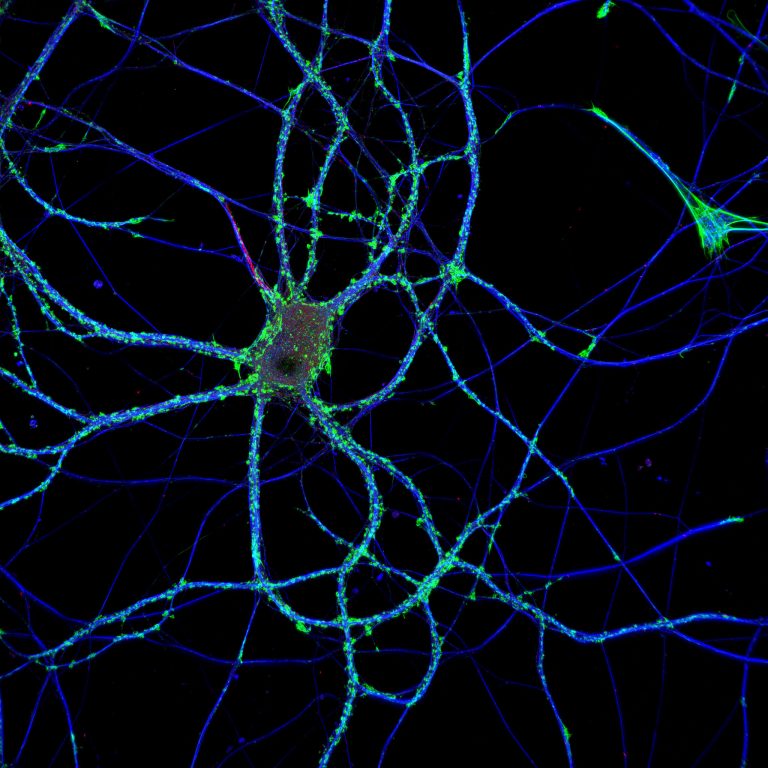 Hippocampal neuron labeled for actin (green), microtubules (blue) and neurofascin (red)