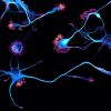 Young neurons labeled for actin (orange) and microtubules (cyan)