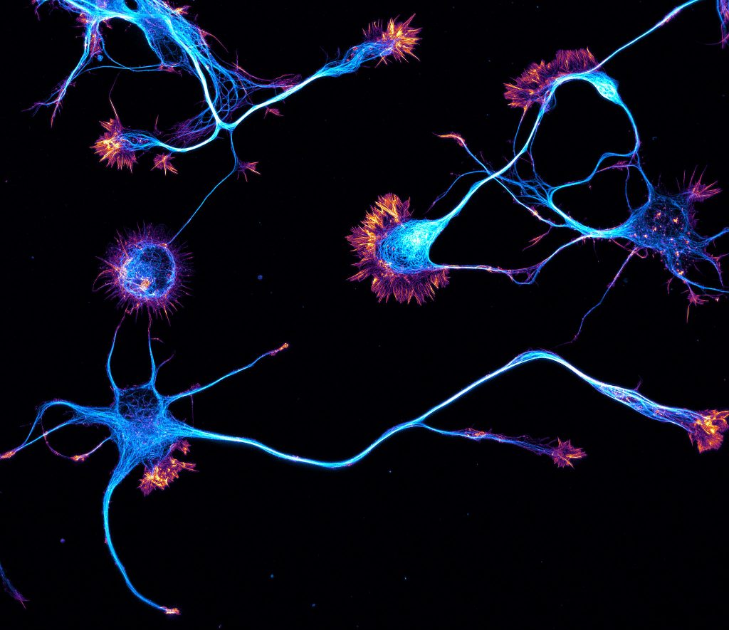 Young neurons labeled for actin (orange) and microtubules (cyan)