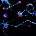 Young neurons labeled for actin (orange) and microtubules (cyan)