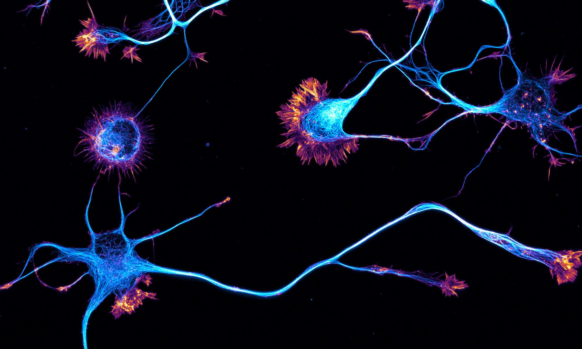 Young neurons labeled for actin (orange) and microtubules (cyan)