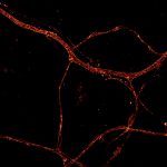 STORM image of an axon labeled for actin