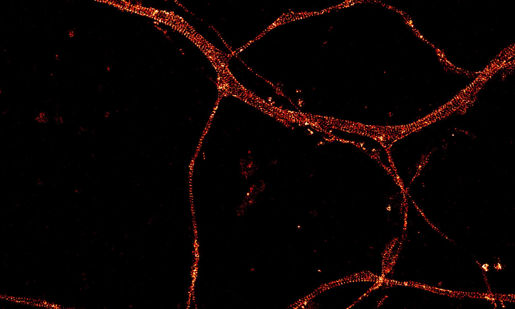 STORM image of an axon labeled for actin