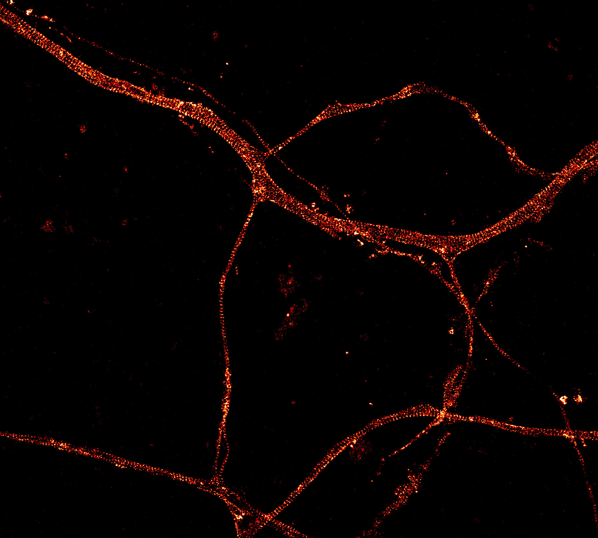 STORM image of an axon labeled for actin