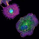 COS cells labeled for actin (purple), microtubules (green) and nucleus (blue) COS cells labeled for actin (purple), microtubules (green) and nucleus (blue)