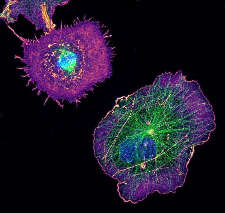 COS cells labeled for actin (purple), microtubules (green) and nucleus (blue) COS cells labeled for actin (purple), microtubules (green) and nucleus (blue)