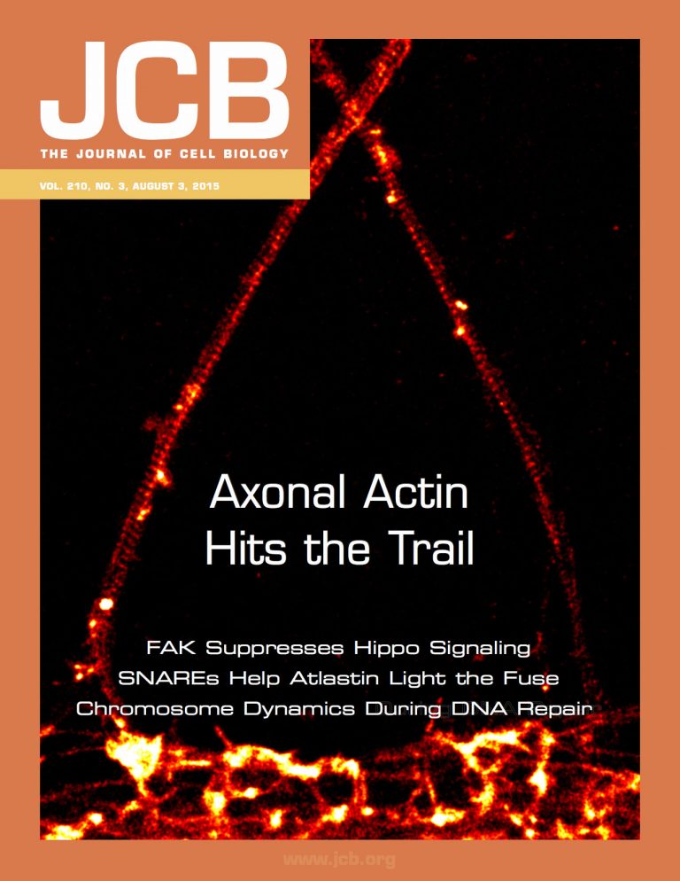 STORM images of actin showing axons (top) contacting a dendrite (bottom), cover of J. Cell. Biol. August 2015 issue STORM images of actin showing axons (top) contacting a dendrite (bottom), cover of J. Cell. Biol. August 2015 issue