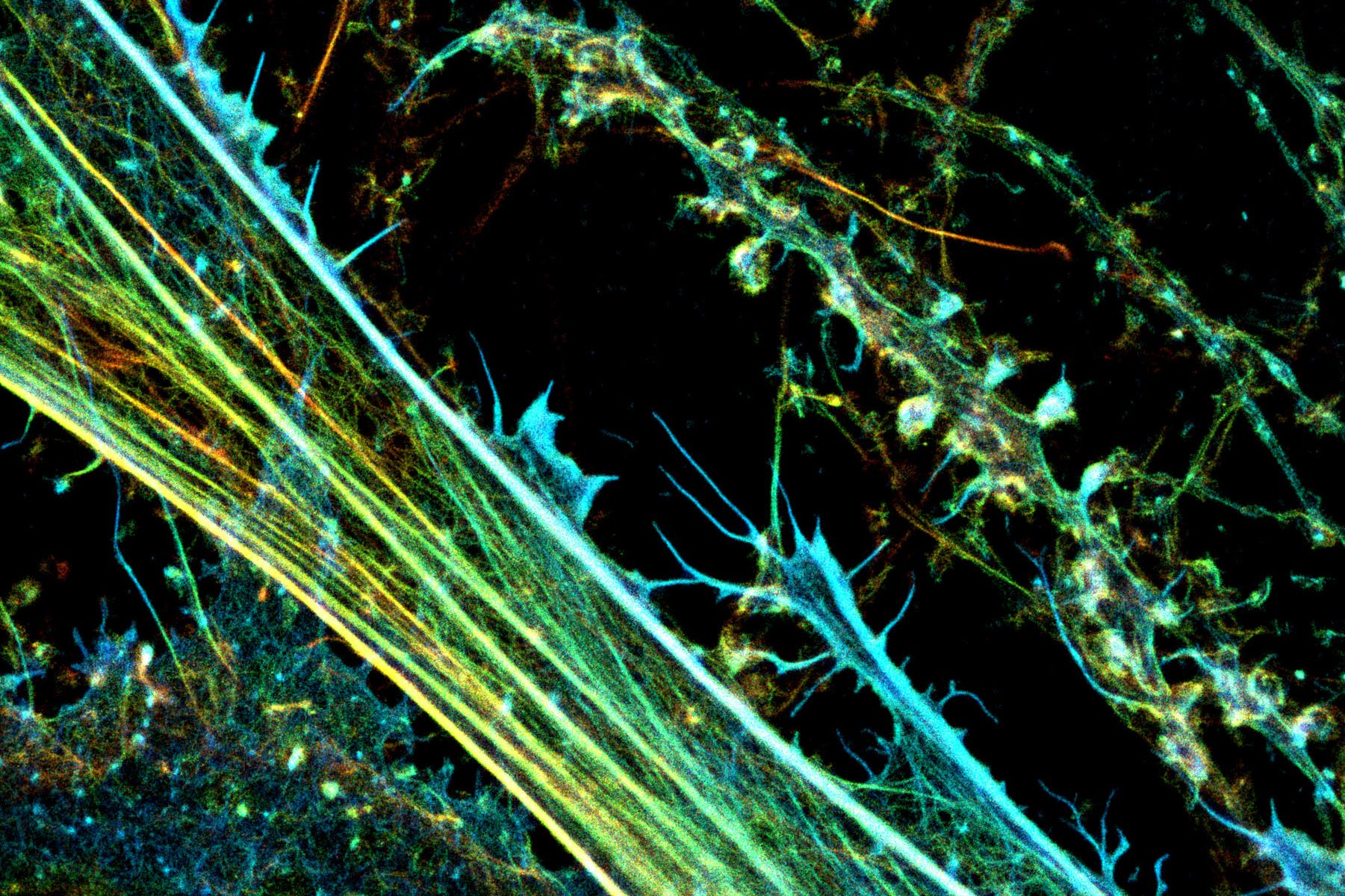 3D-STORM image of a neuronal culture labeled for actin (depth color-code)